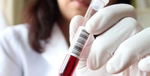 Folik Asit Testi Nedir ve Nasıl Yapılır?